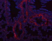 Immunofluorescent staining of FFPE rat lung tissue with Collagen I antibody (red) and DAPI nuclear stain (blue). HIER: steam section in pH8 EDTA buffer for 20 min.