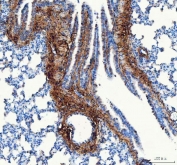 IHC staining of FFPE rat lung tissue with Collagen I antibody. HIER: boil tissue sections in pH8 EDTA for 20 min and allow to cool before testing.