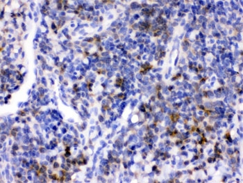 IHC testing of FFPE mouse spleen with CD33 antibody. HIER: Boil the paraffin sections in pH 6, 10mM citrate bu