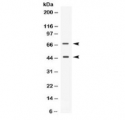 Western blot testing of human SKOV3 cell lysate with anti-CD33 antibody. Predicted molecular weight is 40-67 kDa depending on glycosylation level.