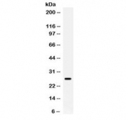 Western blot testing of human placenta lysate with APOA1 antibody. Predicted molecular weight ~30 kDa.