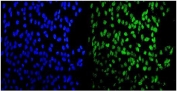Immunofluorescent staining of FFPE human U-2 OS cells with MEF2A antibody (green) and DAPI nuclear stain (blue). HIER: steam section in pH6 citrate buffer for 20 min.
