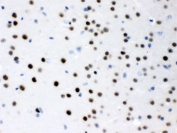 IHC testing of FFPE mouse brain with MEF2A antibody. HIER: Boil the paraffin sections in pH 6, 10mM citrate buffer for 20 minutes and allow to cool prior to testing.