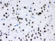IHC testing of FFPE rat brain with MEF2A antibody. HIER: Boil the paraffin sections in pH 6, 10mM citrate buffer for 20 minutes and allow to cool prior to testing.