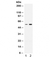 Western blot testing of 1) rat thymus and 2) human HeLa lysate with MEF2A antibody. Expected molecular weight ~55 kDa.