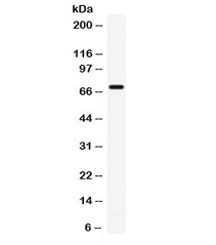 Western blot testing of human 22RV1 cell lysate with IL7R antibody. Predicted molecular weight: ~51/60-90kDa (unmodified/glycosylated).~