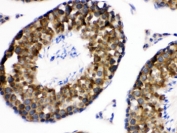 IHC testing of FFPE mouse testis with WNK1 antibody. HIER: Boil the paraffin sections in pH 6, 10mM citrate buffer for 20 minutes and allow to cool prior to testing.