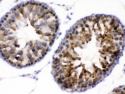 IHC testing of FFPE rat testis with WNK1 antibody. HIER: Boil the paraffin sections in pH 6, 10mM citrate buffer for 20 minutes and allow to cool prior to testing.