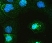 IF/ICC staining of FFPE human A431 cells with GAL4 antibody (green) at 2ug/ml and DAPI nuclear stain (blue). HIER: steam section in pH6 citrate buffer for 20 min.