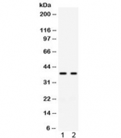 Western blot testing of human 1) SW620 and 2) COLO320 cell lysate with GAL4 antibody. Expected molecular weight ~36 kDa.