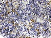 IHC testing of FFPE mouse spleen with C1QBP antibody. HIER: Boil the paraffin sections in pH 6, 10mM citrate buffer for 20 minutes and allow to cool prior to testing.