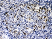 IHC testing of FFPE human tonsil with C1QBP antibody. HIER: Boil the paraffin sections in pH 6, 10mM citrate buffer for 20 minutes and allow to cool prior to testing.