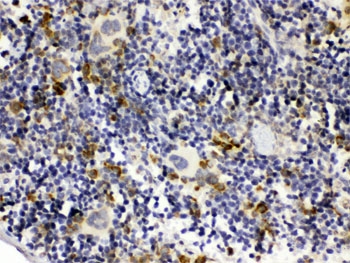 IHC testing of FFPE mouse spleen with C1QBP antibody. HIER: Boil the paraffin sections in pH 6, 10mM citrate buffer for 20 minutes and allow to cool prior to testing.
