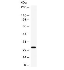 Western blot testing of human 22RV1 cell lysate with HE4 antibody. Expected/observed molecular weight: ~13/25kDa (unmodified/glycosylated).