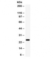 Western blot testing of human 22RV1 cell lysate with HE4 antibody. Expected molecular weight: 13-25 kDa, depending on glycosylation level.
