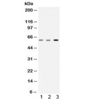 Western blot testing of 1) rat skeletal muscle, 2) mouse skeletal muscle and 3) human A549 lysate with Catalase antibody. Expected/observed molecular weight ~60 kDa.