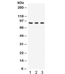 Western blot testing of human 1) A549, 2) 293 and 3) HeLa cell lysate with Complement Factor B antibody. Expected/observed molecular weight ~86 kDa.~