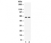 Western blot testing of 1) rat kidney and 2) human HeLa lysate with CCT3 antibody. Expected molecular weight ~61 kDa.