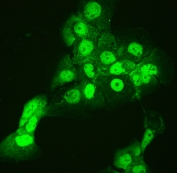 IF/ICC staining of FFPE human A431 cells with CCT3 antibody (green) at 2ug/ml. HIER: steam section in pH6 citrate buffer for 20 min.