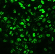 IF/ICC staining of FFPE human A431 cells with CCT3 antibody (green) at 2ug/ml. HIER: steam section in pH6 citrate buffer for 20 min.