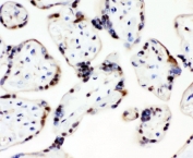IHC staining of FFPE human placenta with CCT3 antibody. HIER: boil tissue sections in pH6, 10mM citrate buffer, for 10-20 min and allow to cool before testing.