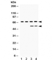 Western blot testing of 1) rat testis, 2) mouse ovary, 3) human HeLa and 4) human MCF7 lysate with YAP1 antibody. Predicted molecular weight: 54 kDa but routinely observed at 65-70 kDa.