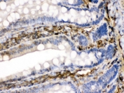 IHC testing of FFPE rat intestine with FGF-1 antibody. HIER: Boil the paraffin sections in pH 6, 10mM citrate buffer for 20 minutes and allow to cool prior to testing.