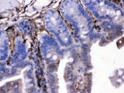 IHC testing of FFPE mouse intestine with FGF-1 antibody. HIER: Boil the paraffin sections in pH 6, 10mM citrate buffer for 20 minutes and allow to cool prior to testing.