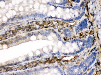 IHC testing of FFPE rat intestine with FGF-1 antibody. HIER: Boil the paraffin sections in pH 6, 10mM citrate buffer for 20 minutes and allow to cool prior to testing.