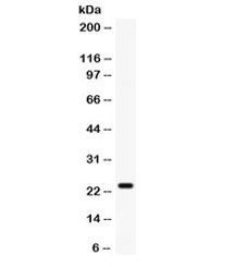 Western blot testing of rat heart lysate with FGF-1 antibody. Predicted molecular weight ~17 kDa, observed here at ~24 kDa.