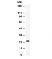 Western blot testing of rat heart lysate with FGF-1 antibody. Predicted molecular weight ~17 kDa, observed here at ~24 kDa.