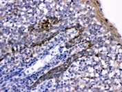 IHC testing of FFPE human tonsil with CD58 antibody. HIER: Boil the paraffin sections in pH 6, 10mM citrate buffer for 20 minutes and allow to cool prior to testing.