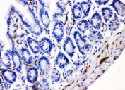 IHC testing of FFPE mouse intestinal tissue with VIP antibody. HIER: Boil the paraffin sections in pH8 EDTA buffer for 20 minutes and allow to cool prior to testing.