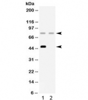 Western blot testing of 1) rat liver and 2) human HeLa lysate with Factor I antibody. Expected molecular weight: 66 kDa (unmodified), 88 kDa (fully glycosylated), 50/38 kDa (fully glycosylated heavy/light chain).