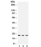 Western blot testing of 1) rat liver, 2) mouse brain and 3) human HeLa lysate with Cofilin 2 antibody. Predicted molecular weight: ~19kDa.