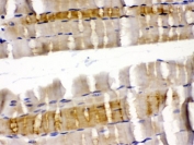 IHC testing of FFPE rat skeletal muscle with Cofilin 2 antibody. HIER: Boil the paraffin sections in pH 6, 10mM citrate buffer for 20 minutes and allow to cool prior to testing.