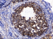 IHC testing of FFPE mouse ovary with TCP1 epsilon antibody. HIER: Boil the paraffin sections in pH 6, 10mM citrate buffer for 20 minutes and allow to cool prior to testing.