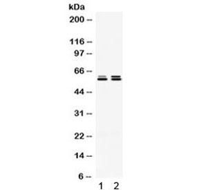 Western blot testing of 1) rat testis and 2) human HeLa lysate with TCP1 epsilon antibody. Expected/observed molecular weight ~60 kDa.