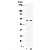 Western blot testing of 1) rat testis and 2) human HeLa lysate with TCP1 epsilon antibody. Expected molecular weight ~60 kDa.