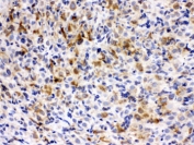 IHC testing of FFPE rat ovary with TCP1 epsilon antibody. HIER: Boil the paraffin sections in pH 6, 10mM citrate buffer for 20 minutes and allow to cool prior to testing.
