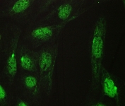 Immunofluorescent staining of FFPE human U-2 OS cells with TCP1 epsilon antibody (green) at 2ug/ml. HIER: steam section in pH6 citrate buffer for 20 min.