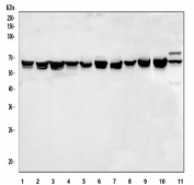 Western blot testing of 1) human HeLa, 2) human MCF7, 3) human SiHa, 4) human A549, 5) human 293T, 6) human Caco-2, 7) human PC-3, 8) human U-2 OS, 9) rat testis, 10) mouse testis and 11) mouse liver tissue lysate with TCP1 epsilon antibody. Expected molecular weight ~60 kDa.