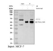 Immunoprecipitation of TCP1 epsilon protein from 500ug of human MCF7 whole cell lysate with 2ug of TCP1 epsilon antibody.