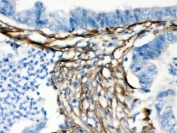 IHC testing of FFPE human intestine with Caldesmon antibody. HIER: Boil the paraffin sections in pH8 EDTA buffer for 20 minutes and allow to cool prior to testing.