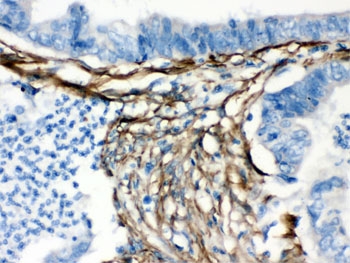IHC testing of FFPE human intestine with Caldesmon antibody. HIER: Boil the paraffin sections in pH 6, 10mM citrate buffer for 20 minutes and allow to cool prior to testing.