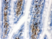 IHC testing of FFPE rat intestine with Caldesmon antibody. HIER: Boil the paraffin sections in pH8 EDTA buffer for 20 minutes and allow to cool prior to testing.