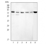 Western blot testing of 1) human U-2 OS, 2) human A549, 3) human HepG2, 4) human HeLa, 5) human Caco-2 and 6) mouse NIH 3T3 cell lysate with Caldesmon antibody. Predicted molecular weight ~93 kDa, can be observed at 70-80 kDa (non muscle tissue) and 120-150 kDa (smooth muscle).