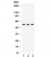 Western blot testing of 1) rat lung, 2) mouse liver and 3) human HeLa lysate with Integrin linked kinase antibody. Expected molecular weight: 51-59 kDa.