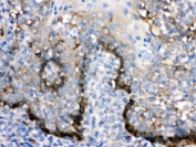 IHC testing of FFPE human tonsil with ZAP70 antibody. HIER: Boil the paraffin sections in pH 6, 10mM citrate buffer for 20 minutes and allow to cool prior to testing.