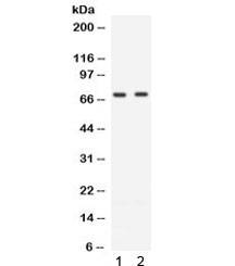 Western blot testing of human 1) Jurkat and 2) CEM cell lysate with ZAP70 antibody. Expected molecular weight ~70 kDa.~